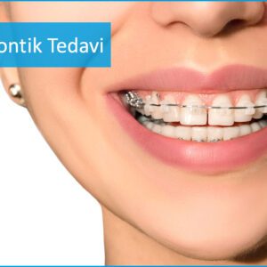Ortodontik Tedaviler