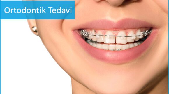 Ortodontik Tedaviler